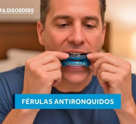 ferulas antironquidos