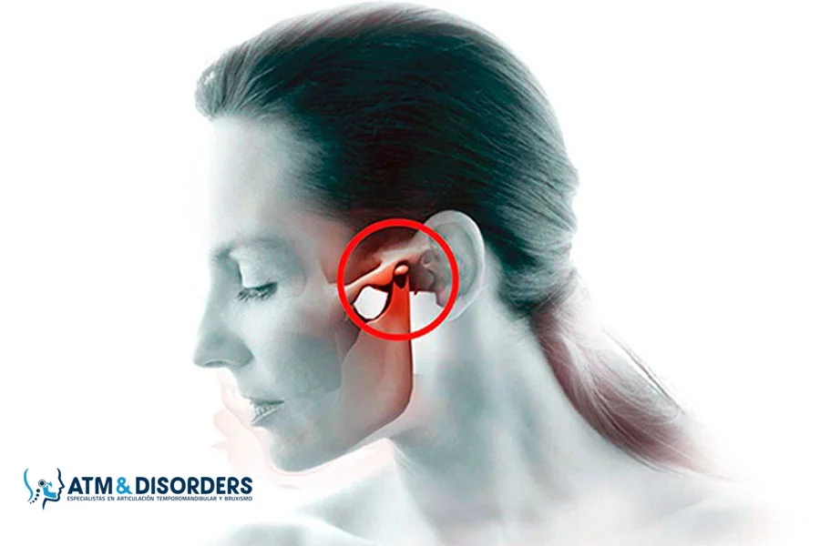 Cual es La Articulación Temporomandibular